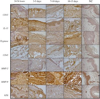 Wound Vitality in Decomposed Bodies: New Frontiers Through Immunohistochemistry